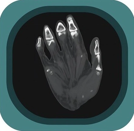 CT hand anatomy icon
